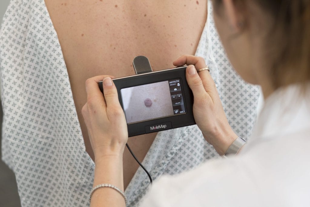 Dermatologist using MoleMap technology for precise skin cancer detection, capturing detailed images of moles to identify potential melanoma and other concerns.