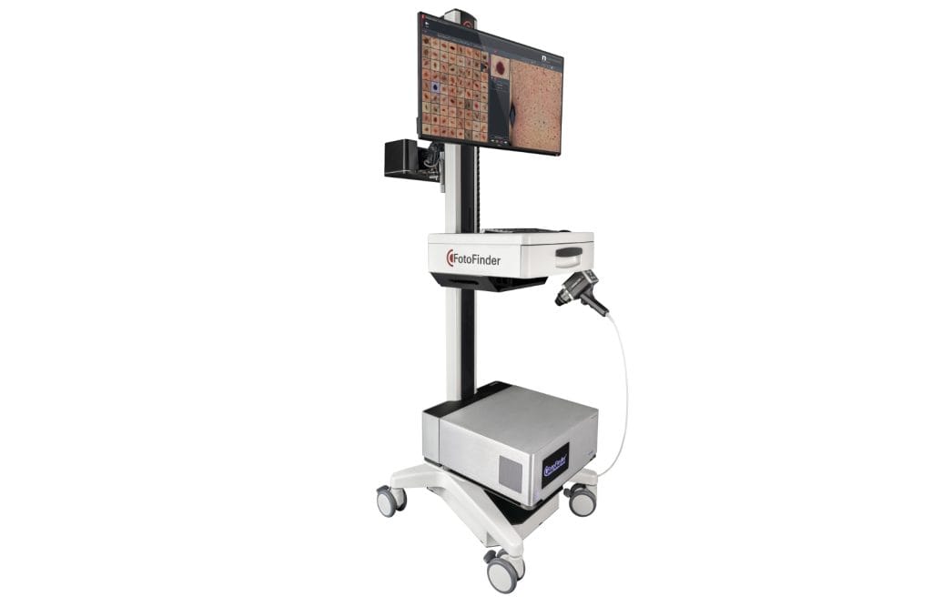 FotoFinder ATM device for Automated Total Body Mapping at Dermascan. Advanced Al-powered skin cancer detection technology for comprehensive body imaging.