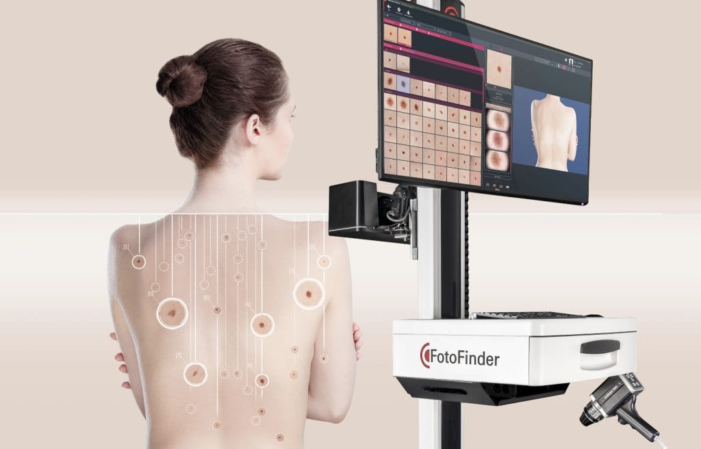Patient undergoing Automated Total Body Mapping with Al-powered FotoFinder technology at Dermascan for early detection of skin cancer and precise lesion analysis.